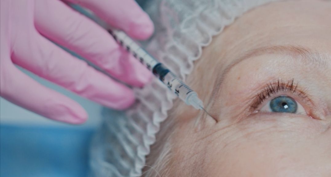 botox kezelés ránctalanitás arc lifting anti-ageing nyusziránc, homlokránc, marionett redö, glabella, szemkörnyék, áll